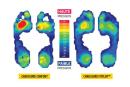 FITFLOP - des chaussures pour la santé des pieds
